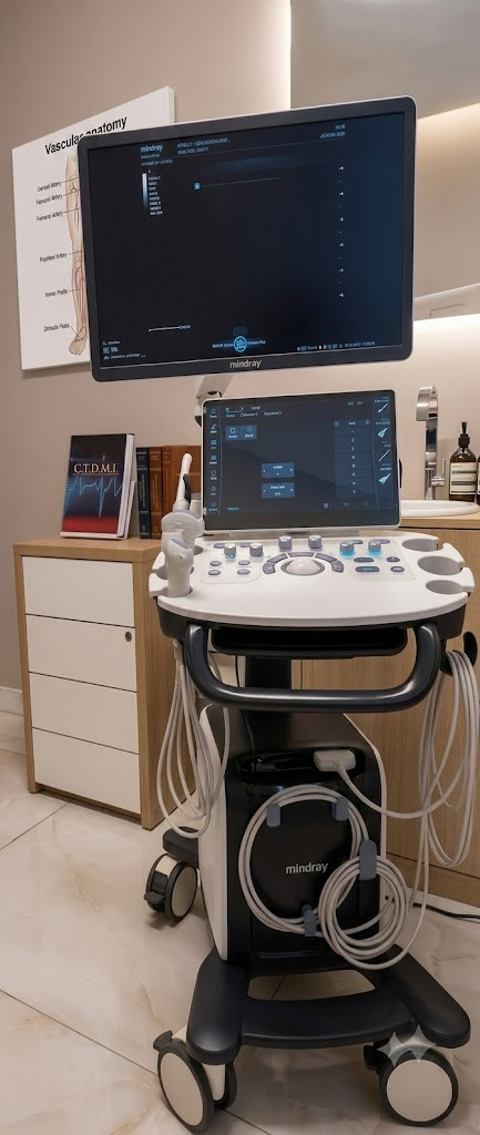 Equipamento de Eco Doppler da clínica C.T.D.M.I. no Méier